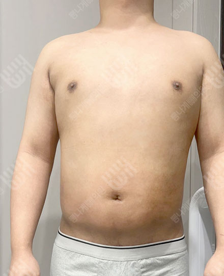 ผู้ชาย복부5 후