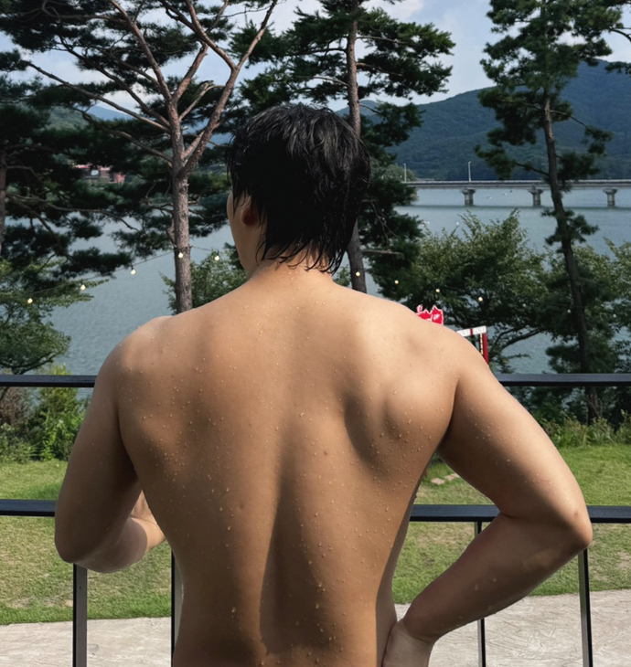 BBAE CLINIC ดูดไขมันแผ่นหลัง